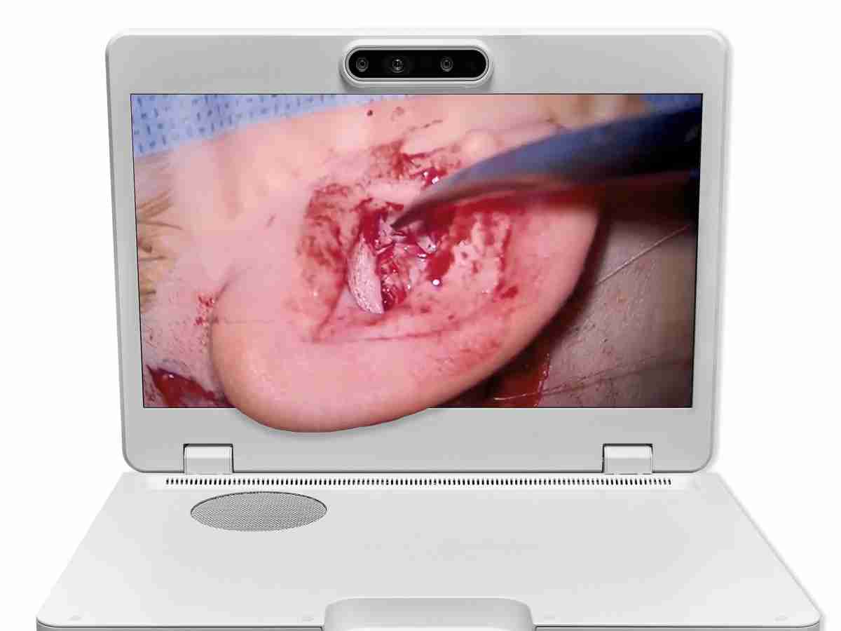 达擎之＂Heads-up 3D显微手术显示系统＂，，，整合4K裸眼3D显示及眼球追踪系统，，，，具备快速追踪人眼移动位置功能，，减轻医师长时间维持固定姿势的负担，，让医师能有更宽广清晰的3D立体视野及更舒适的姿势来执行手术。。。